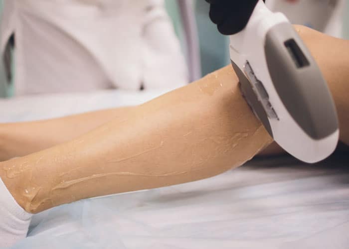 Laser-Treatment-Service-01
